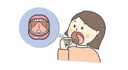 舌下免疫療法